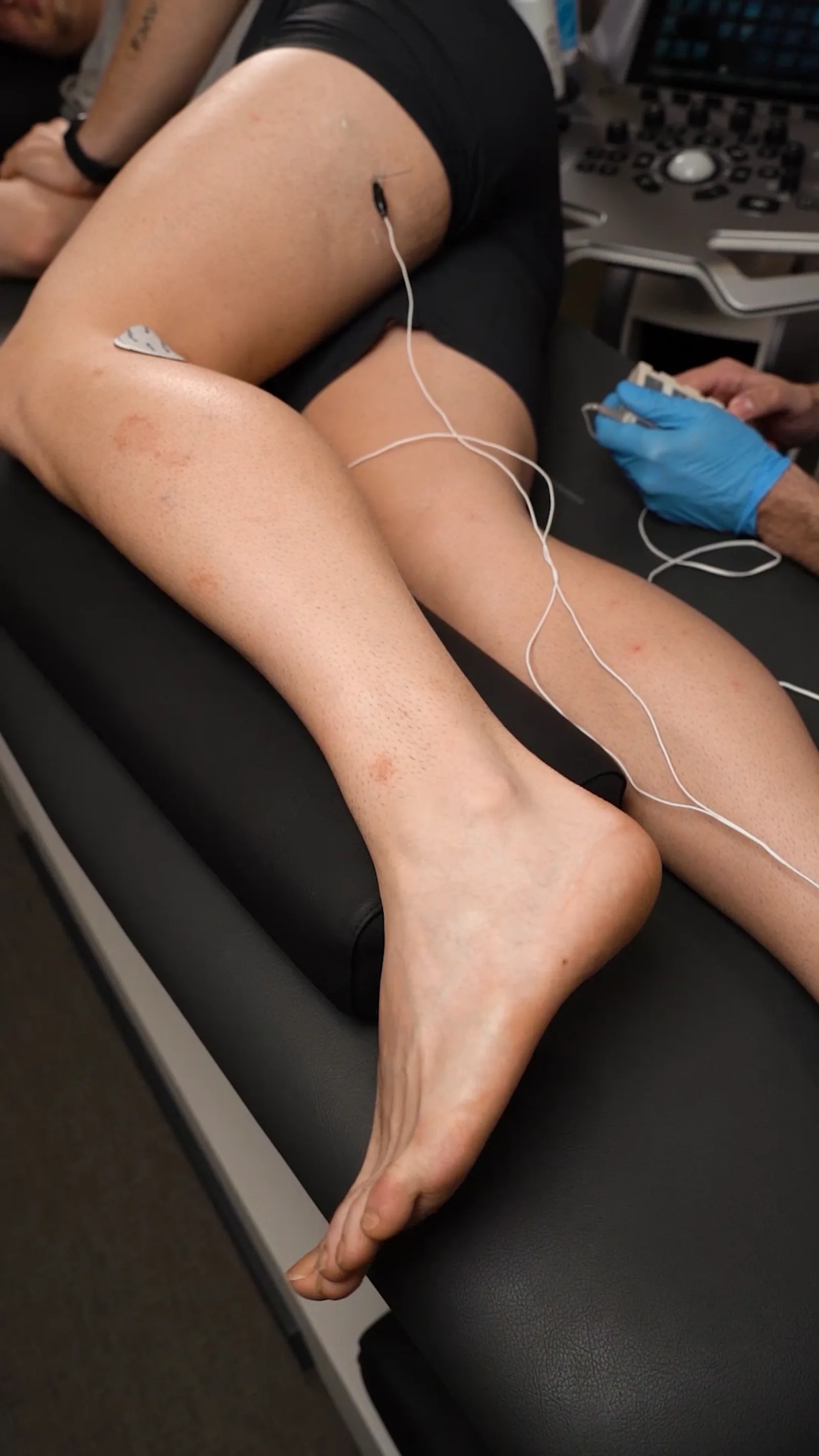 Tratamiento de neuromodulación ecoguiada en Élite Fisioterapia Zaragoza