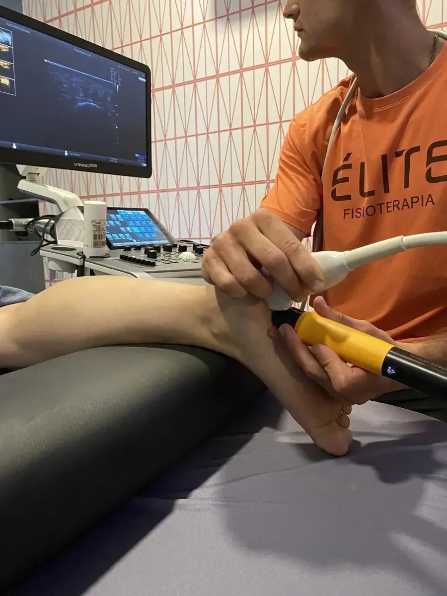 Aplicación de ondas de choque en Élite Fisioterapia Zaragoza
