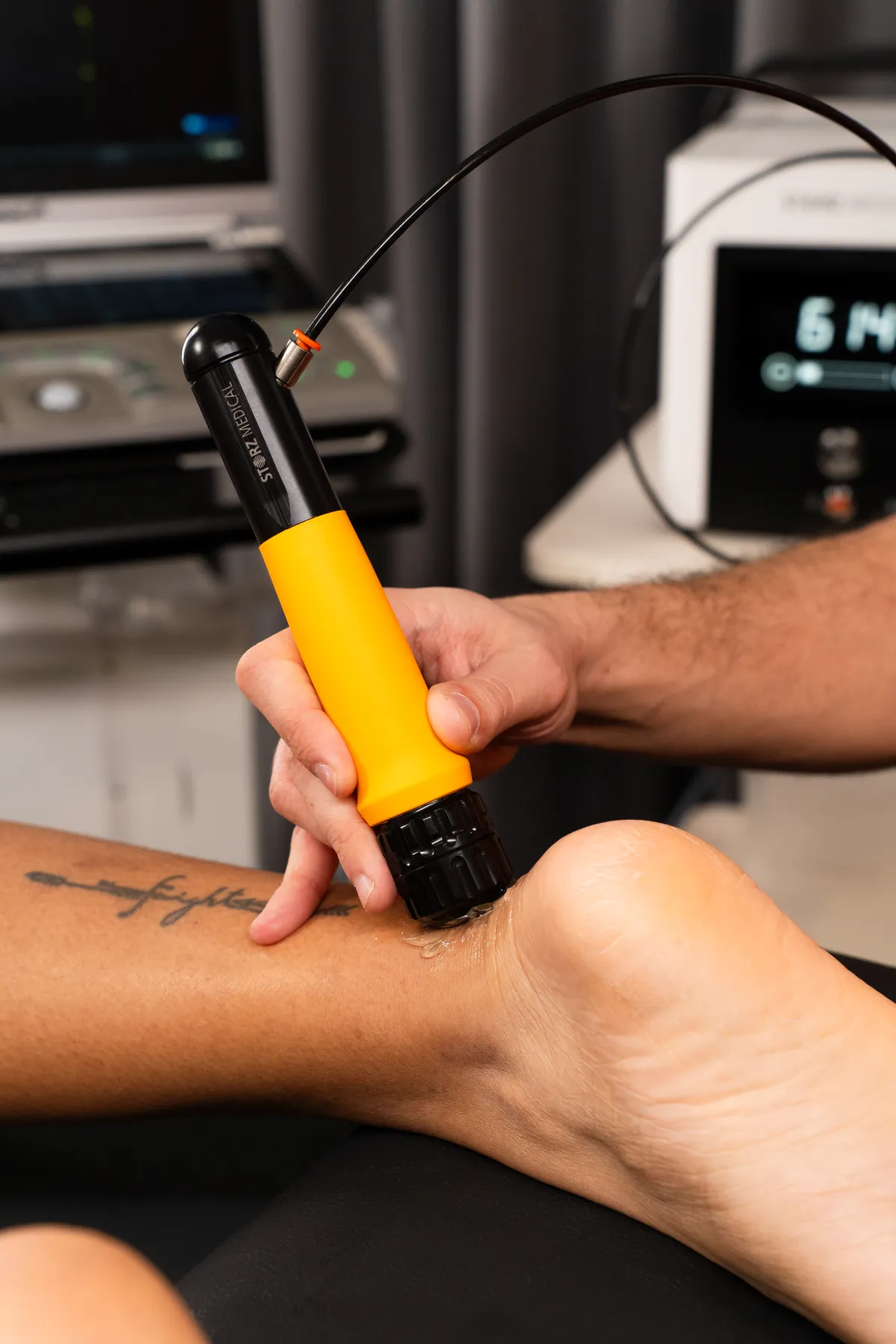 Equipo de ondas de choque ESWT en Élite Fisioterapia Zaragoza