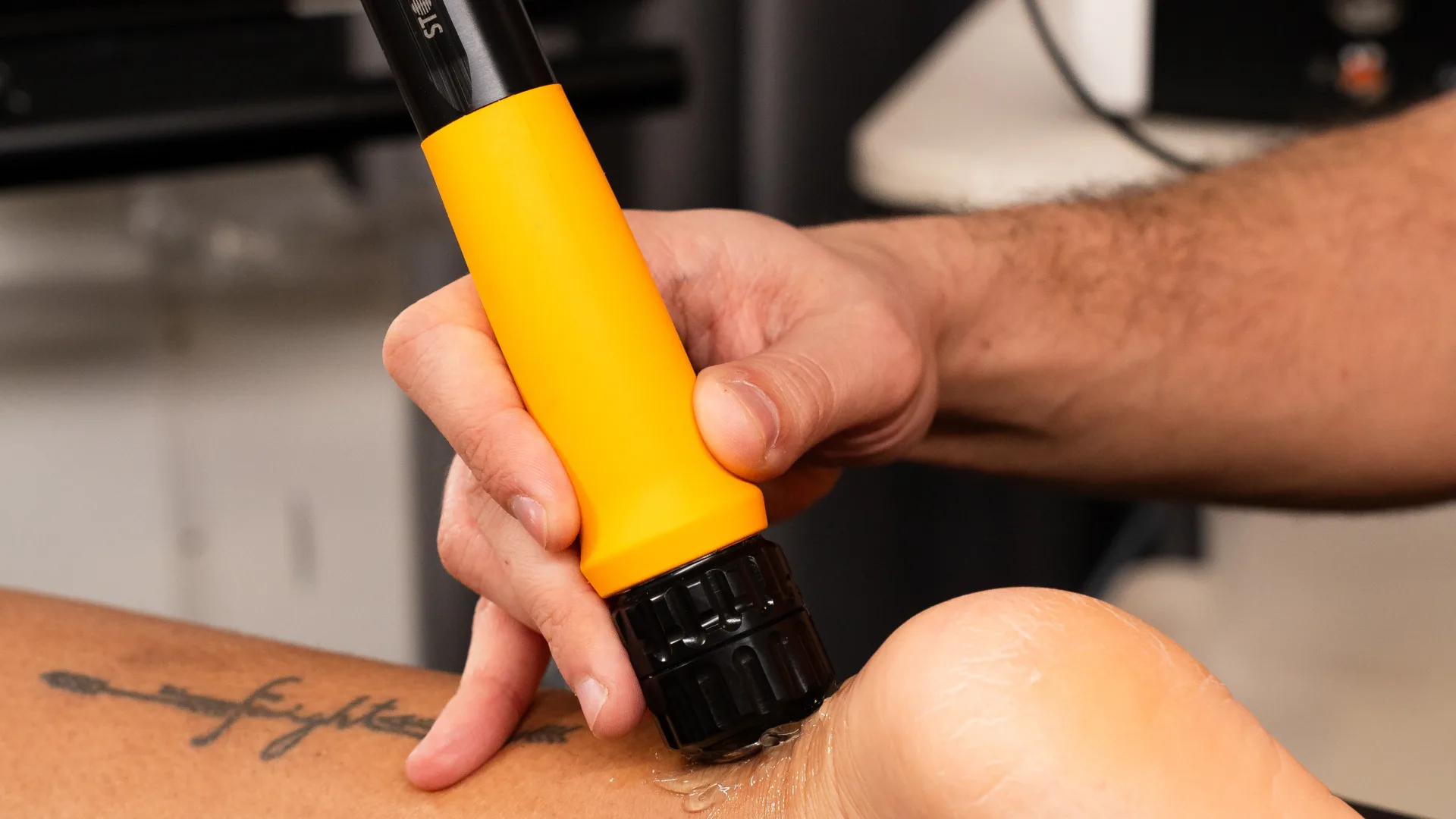 Ondas de choque radiales en Élite Fisioterapia Zaragoza